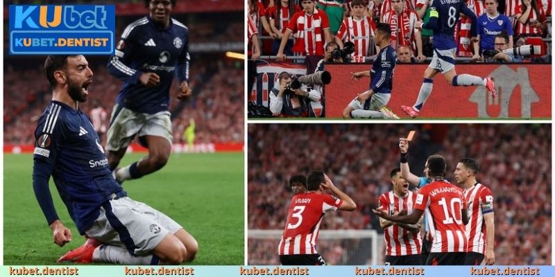 Top Trung Vệ Hay Nhất Ligue 1 Chuyền Bóng Chuẩn Xác 2025